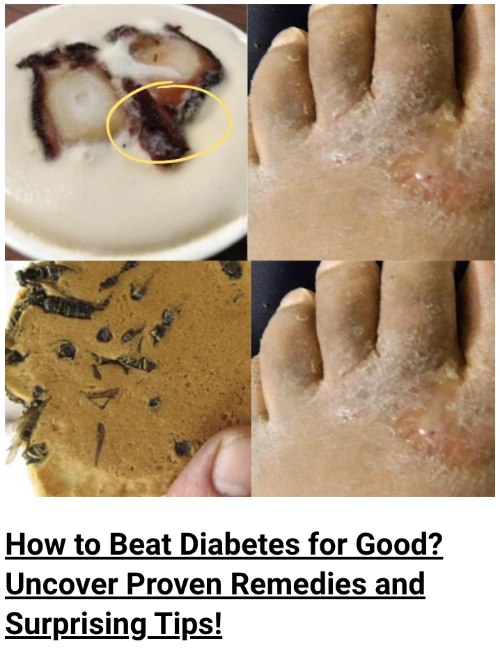 How to Beat Diabetes